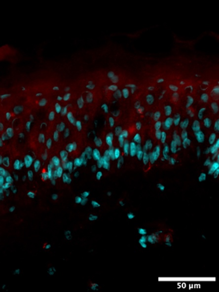 Condition stress + 1-LGVTY®