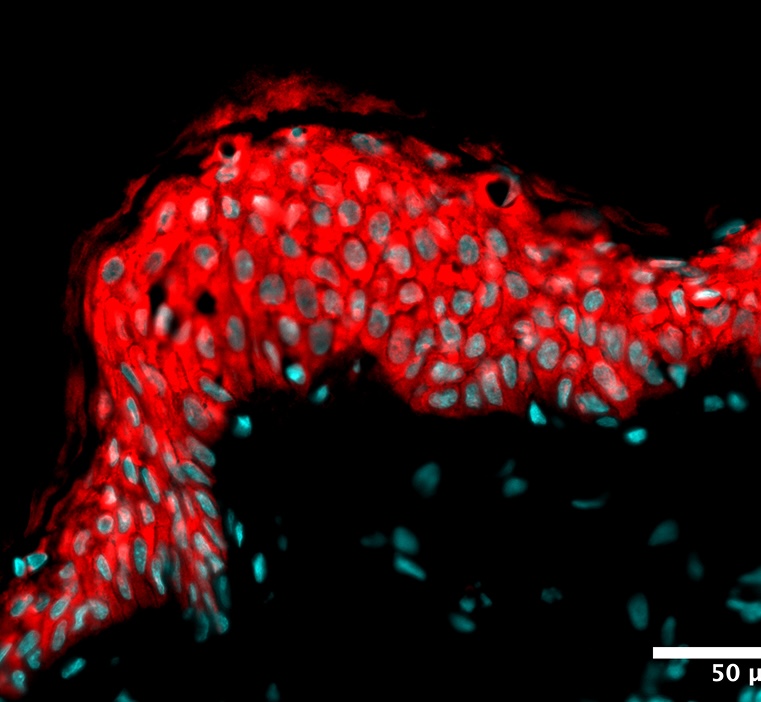 Condition stress + 1-LGVTY®