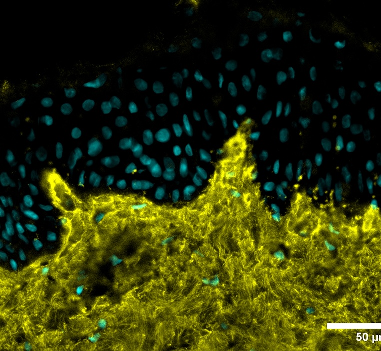 Condition stress + 1-LGVTY®