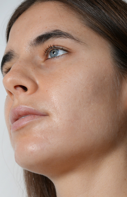 Image d’avant/après