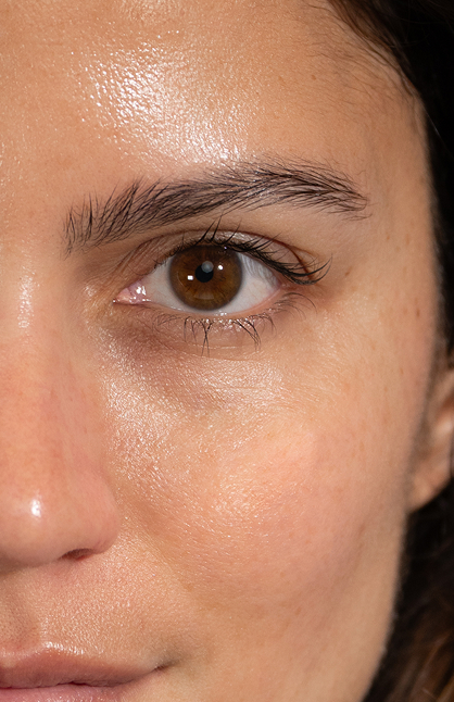 Image d’avant/après